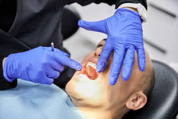 Best Emergency Broken Tooth Repair in Las Lomas, TX